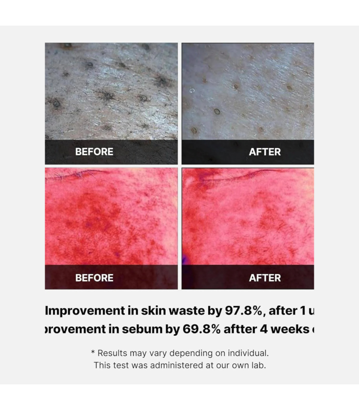 Medicube - Red Succinic Acid Peeling Pad - Dischetti Esfolianti