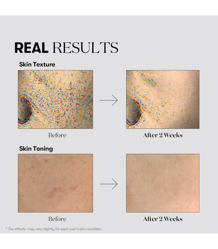 VT Cosmetics - TX-toning Essence 1000 Shot - Brightening Face Essence with Tranexamic Acid - Siero Viso