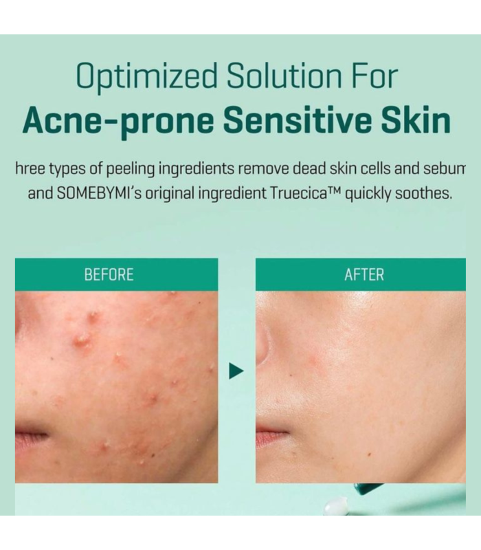 Kit Essenziale Anti-Imperfezioni