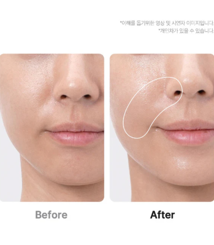 Medicube - AGE-R Booster Pro - Dispositivo Skincare Viso 6-in-1