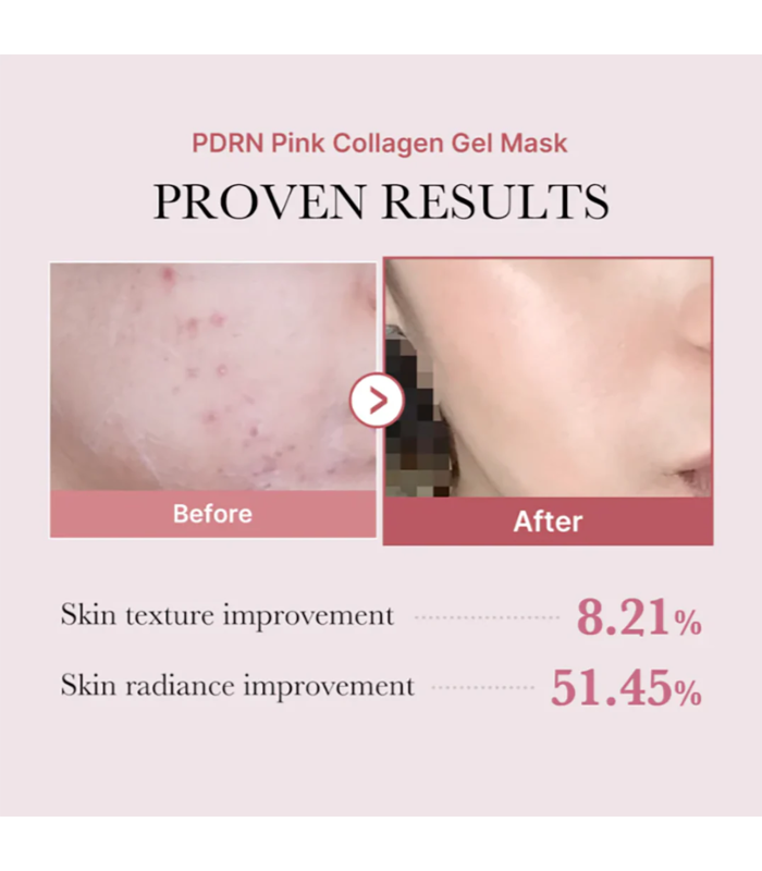 Medicube - PDRN Pink Collagen Gel Mask - Maschera viso al collagene e PDRN rassodante e idratante