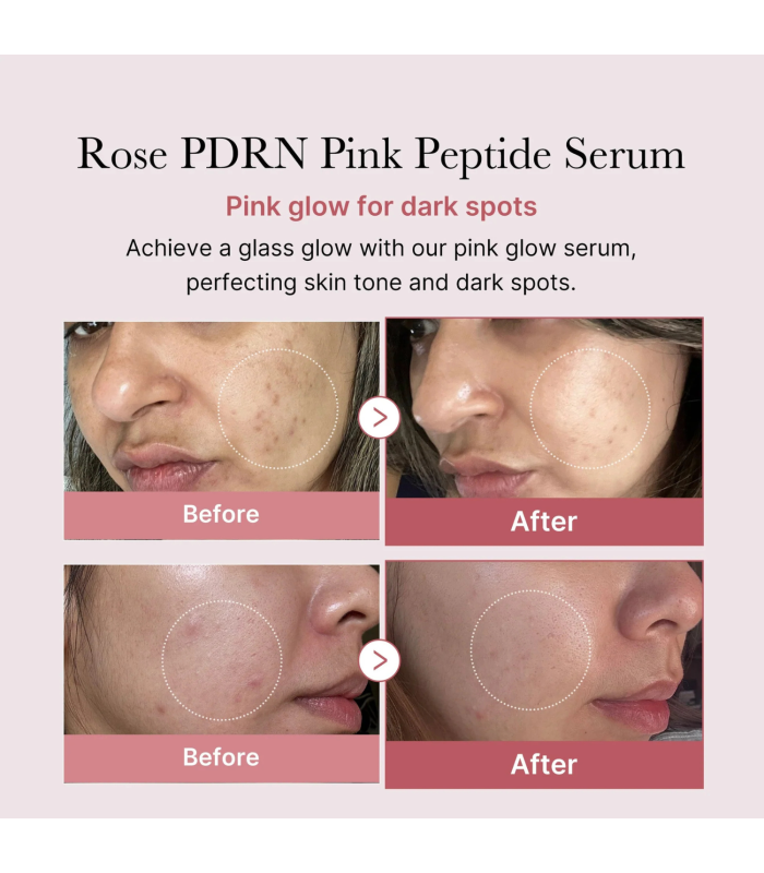 Medicube - PDRN Pink Peptide Serum - Siero viso anti-age rassodante con PDRN e peptidi