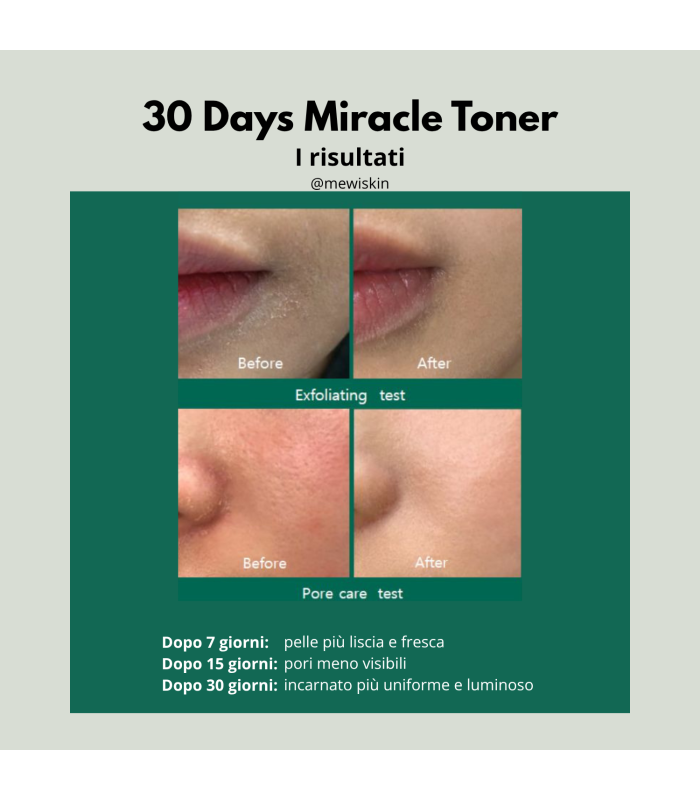 Some By Mi - AHA, BHA, PHA 30 Days Miracle Toner - Tonico viso