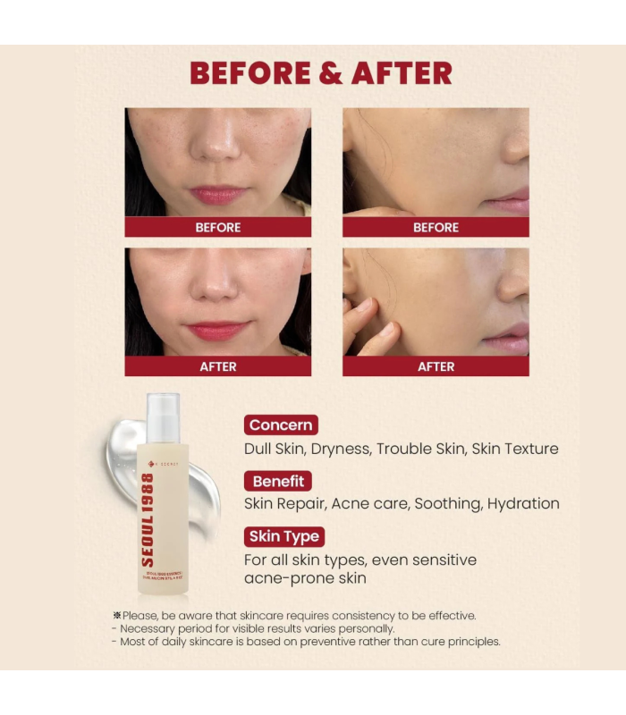 KSECRET - SEOUL 1988 Essence: Snail Mucin 97% + Rice - Essenza viso