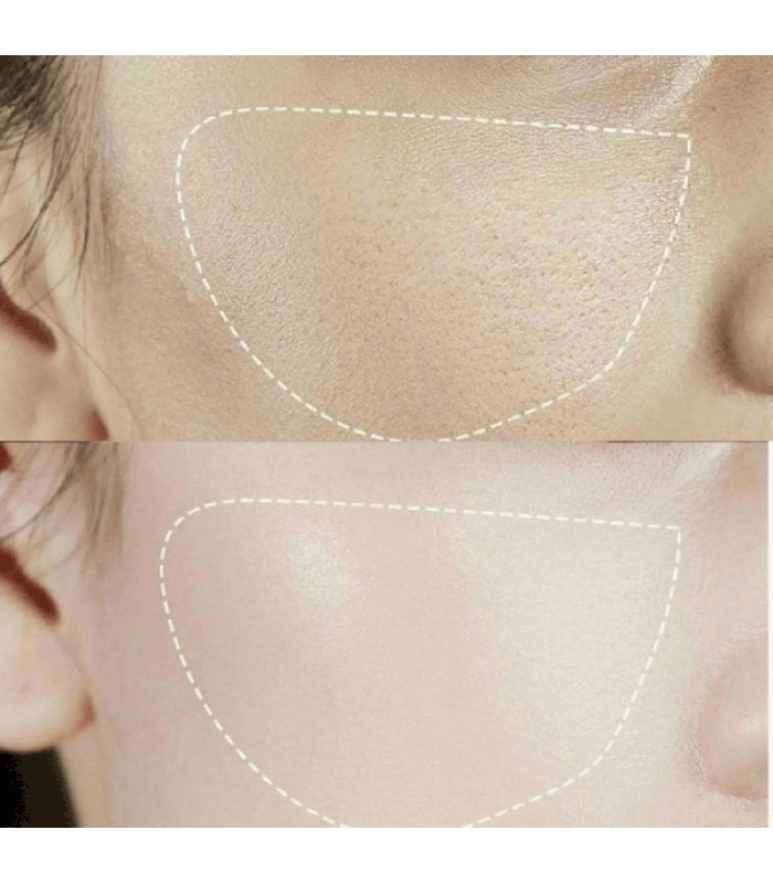 Medi-Peel - Peptide-Tox Bor-Tox Peptide Ampoule - Siero viso ai peptidi anti-age