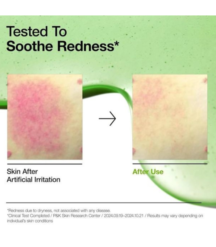 Anua – Azelaic Acid 10 Hyaluron Redness – Siero viso lenitivo anti-rossori