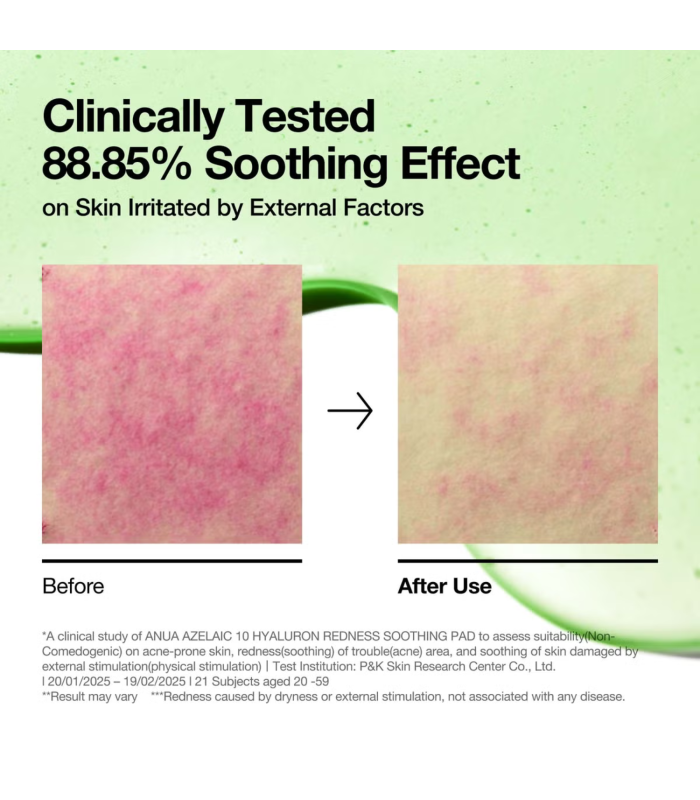 Anua – Azelaic Acid 10 Hyaluron Redness Soothing Pad – Dischetti viso lenitivi anti-rossori