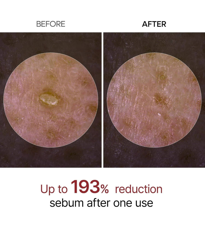 Dr.Melaxin – Peel Shot Exfoliant White Rice Ampoule – Ampoule viso esfoliante e illuminante al riso