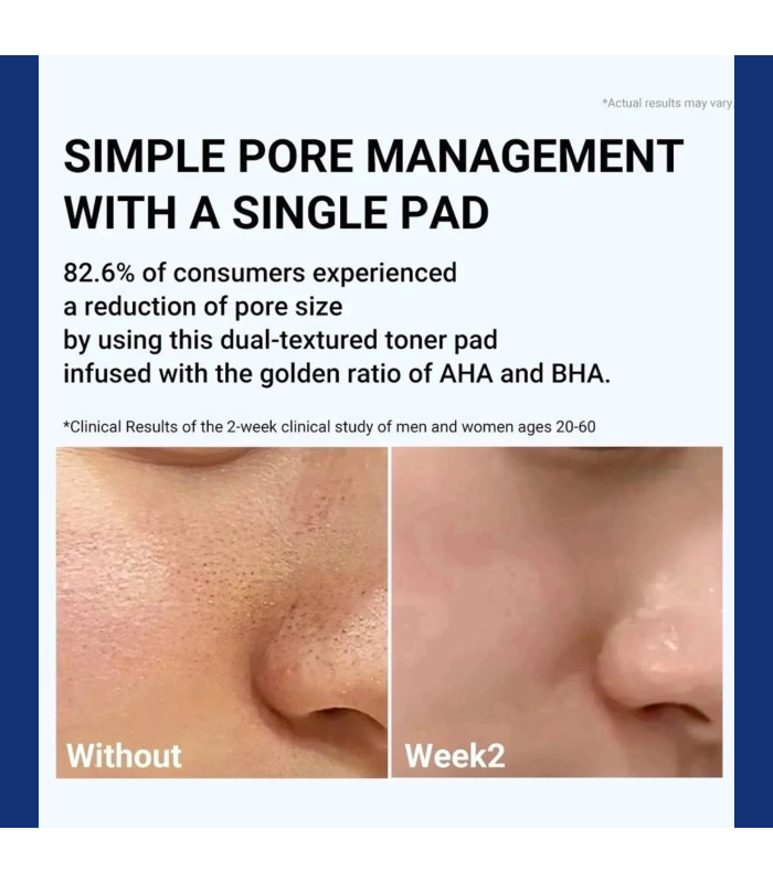 Medicube – Zero Pore Pad 2.0 – Dischetti viso esfolianti anti-pori e sebo