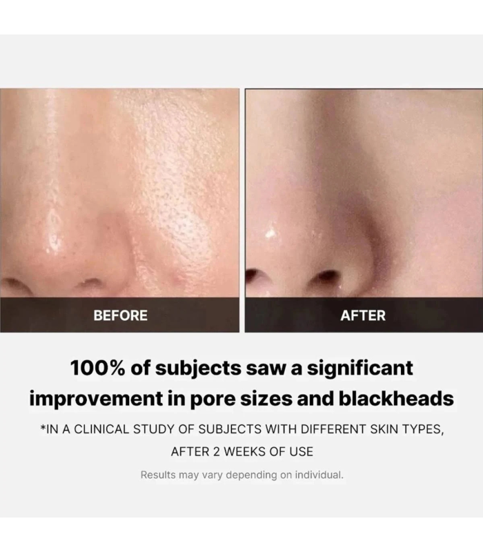 Medicube – Zero Pore Pad 2.0 – Dischetti viso esfolianti anti-pori e sebo