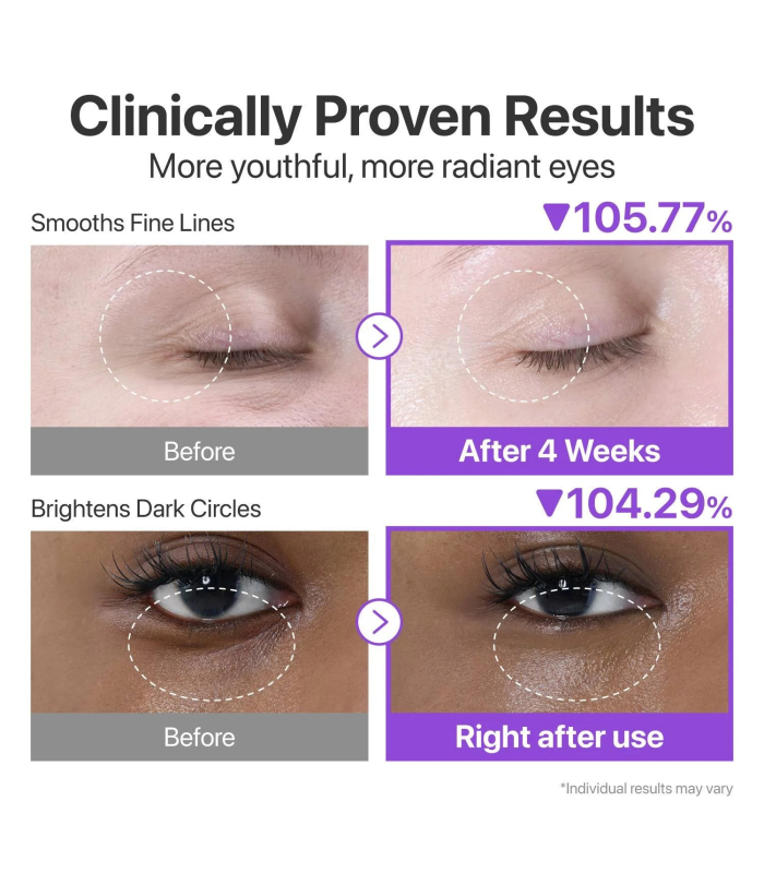 Numbuzin – No.9 NAD+ Retinol Volumetox Eye Cream – Crema contorno occhi anti-age al retinolo