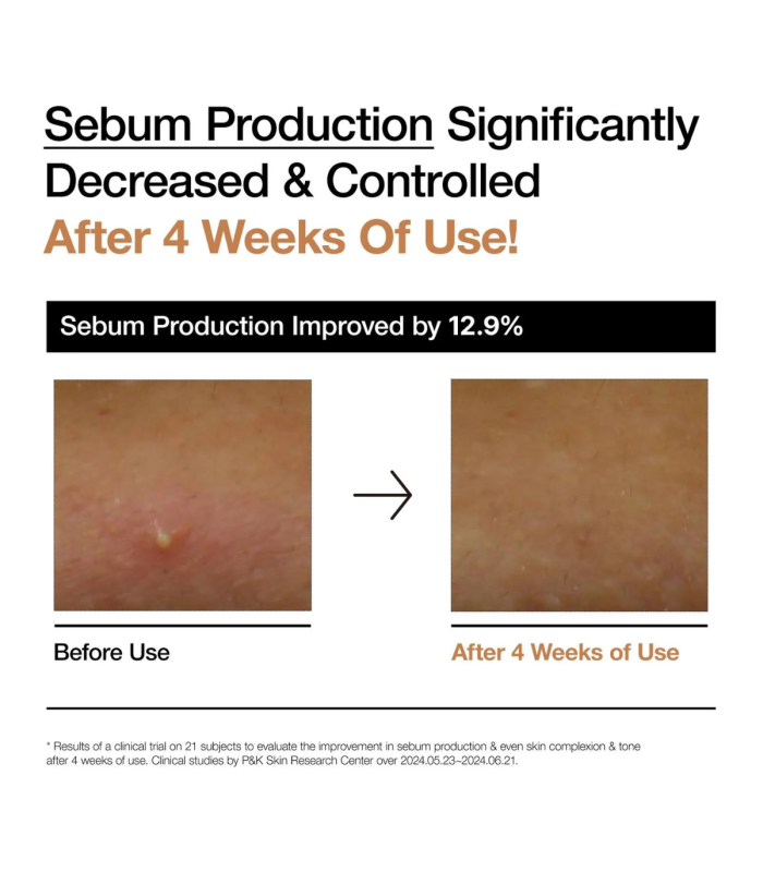 Anua - Rice 70 Glow Milky Toner - Tonico Viso