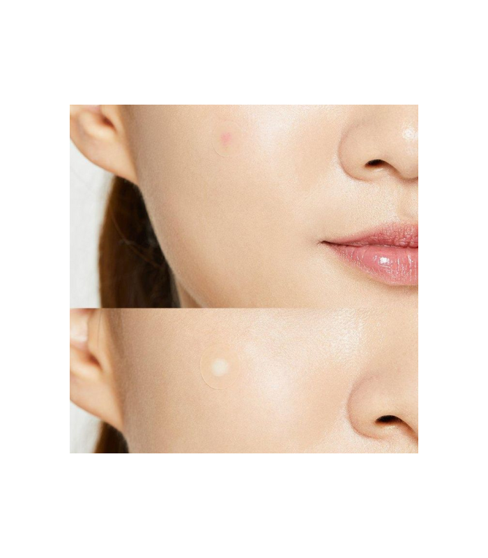 COSRX - Acne Pimple Master Patch - Cerotti Brufoli