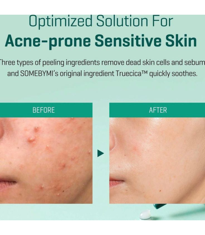 Some By Mi - AHA, BHA, PHA 14 Days Super Miracle Spot All Kill Cream