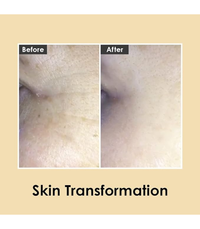 MEDI-PEEL - Peptide 9 Hyaluronic Volumy Eye Cream - Contorno Occhi