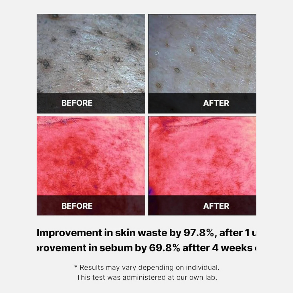 Medicube - Red Succinic Acid Peeling Pad - Dischetti esfolianti viso anti-imperfezioni con acido succinico