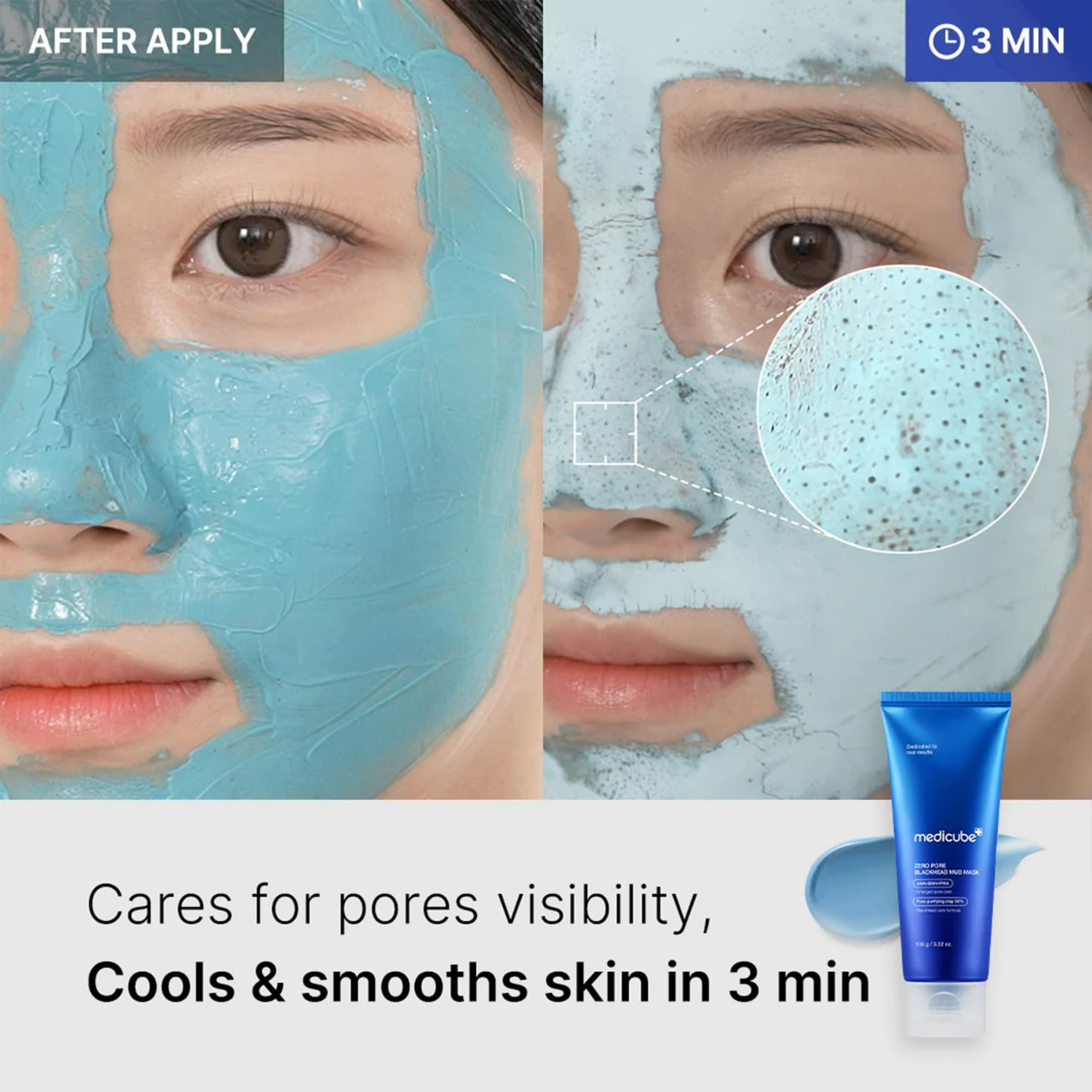Medicube - Zero Pore Blackhead Mud Mask - Maschera viso purificante all’argilla anti-punti neri