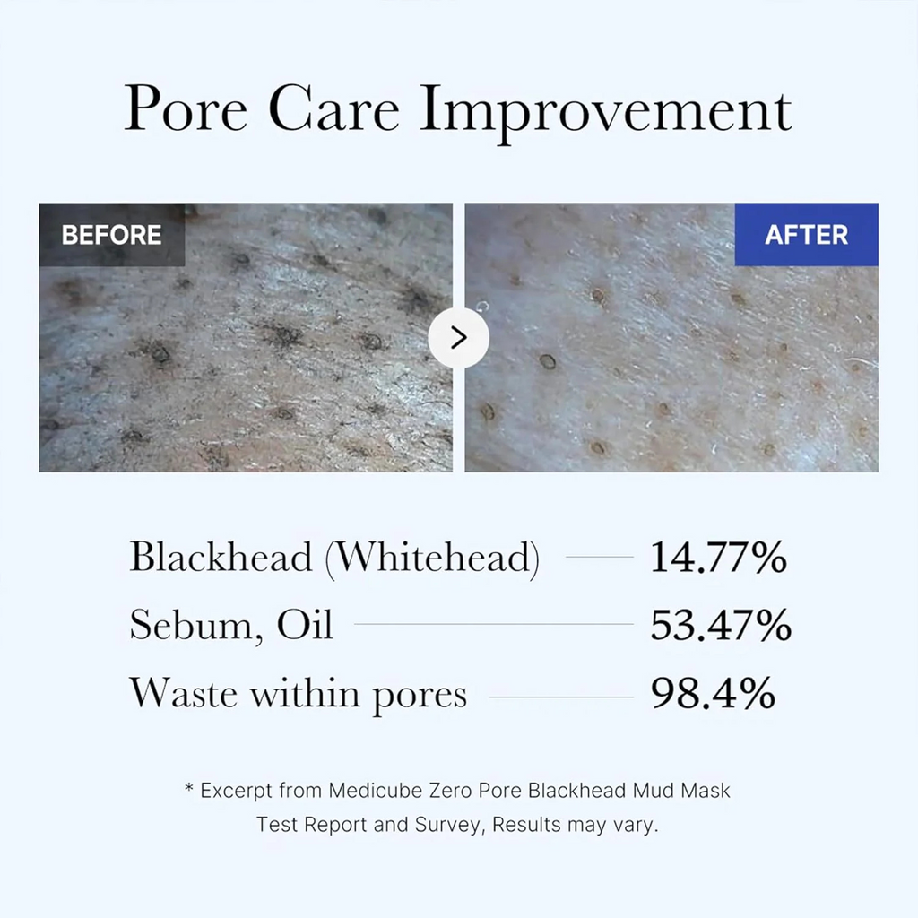 Medicube - Zero Pore Blackhead Mud Mask - Maschera viso purificante all’argilla anti-punti neri