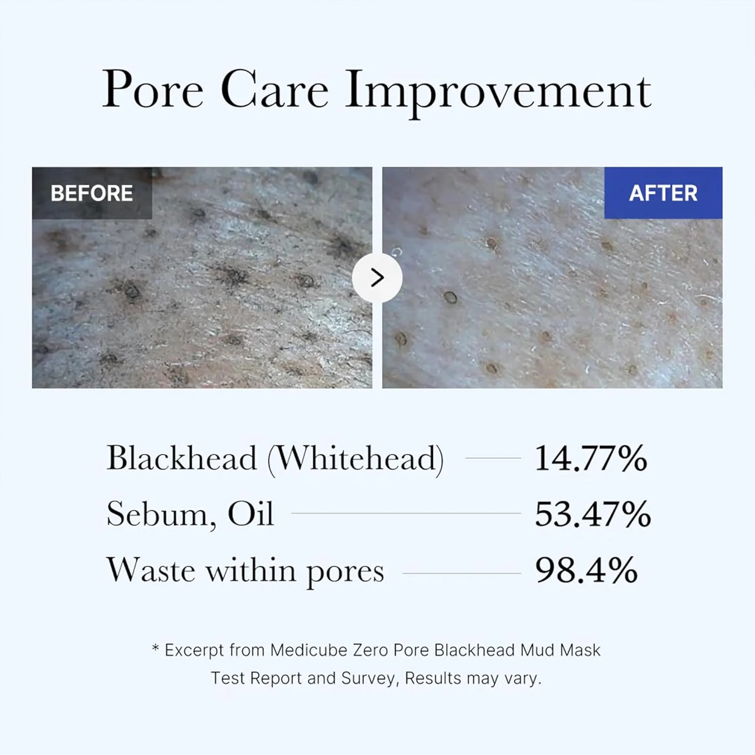 Medicube - Zero Pore Blackhead Mud Mask - Maschera viso purificante all’argilla anti-punti neri