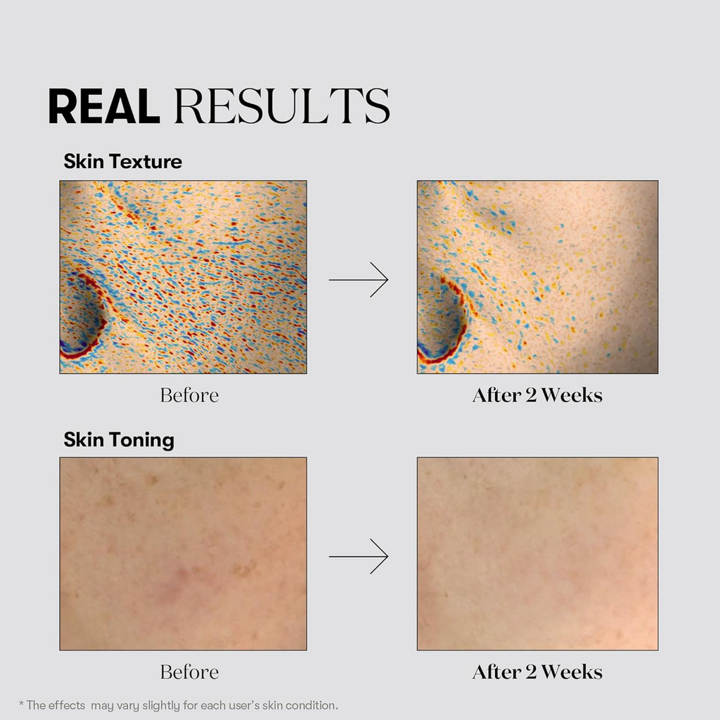 VT Cosmetics - TX-toning Essence 1000 Shot - Essenza viso illuminante anti-macchie con acido tranexamico