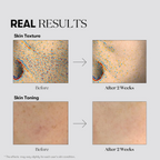 VT Cosmetics – TX-toning Essence 1000 Shot - Essenza viso illuminante anti-macchie con acido tranexamico