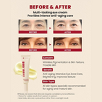 Seoul 1988 Eye Cream: Retinal Liposome 4% + Fermented Bean - Crema contorno occhi anti-età