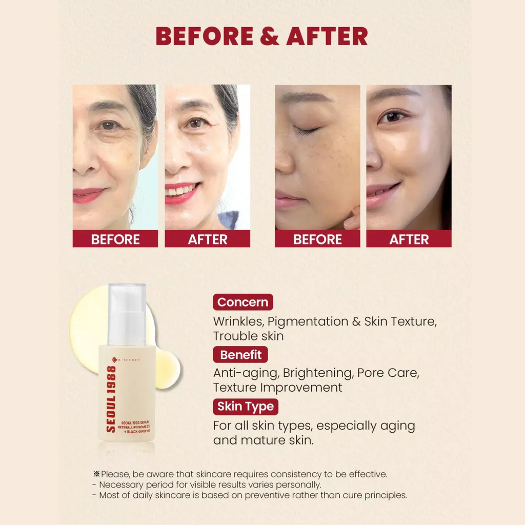 KSECRET - SEOUL 1988 Cream : Retinal Liposome 1% + Fermented Rice - Crema viso anti-eta