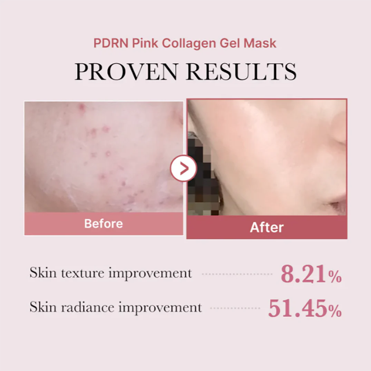 Medicube - PDRN Pink Collagen Gel Mask - Maschera viso al collagene e PDRN rassodante e idratante