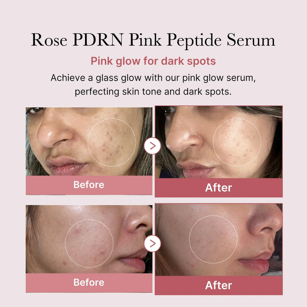 Medicube - PDRN Pink Peptide Serum - Siero viso anti-age rassodante con PDRN e peptidi