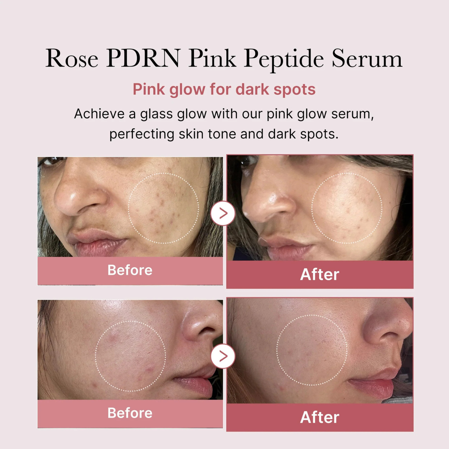 Medicube - PDRN Pink Peptide Serum - Siero viso anti-age rassodante con PDRN e peptidi