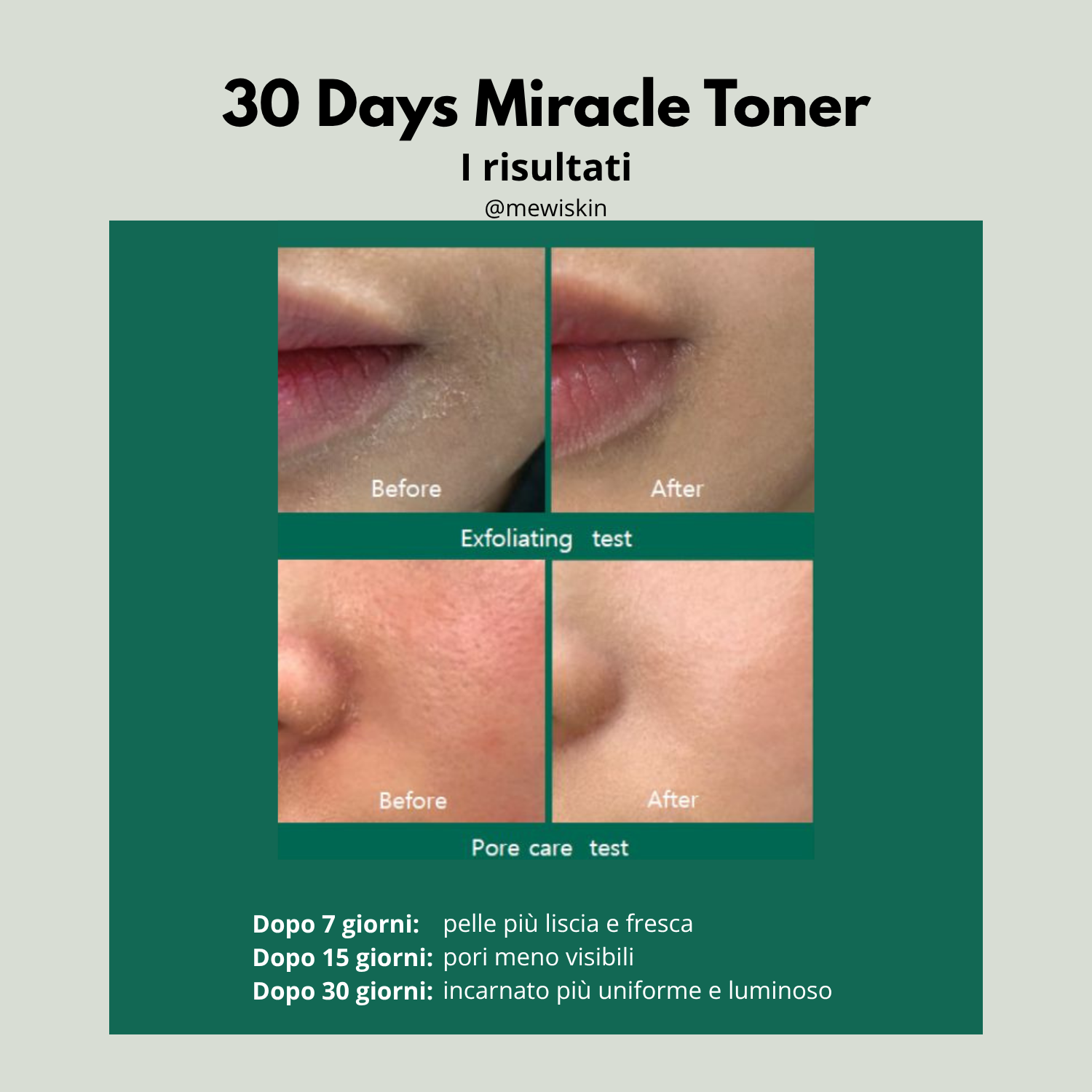 Some By Mi - AHA, BHA, PHA 30 Days Miracle Toner - Tonico viso anti-acne