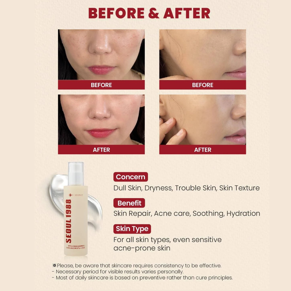 KSECRET - SEOUL 1988 Essence: Snail Mucin 97% + Rice - Essenza viso rigenerante alla bava di lumaca e riso