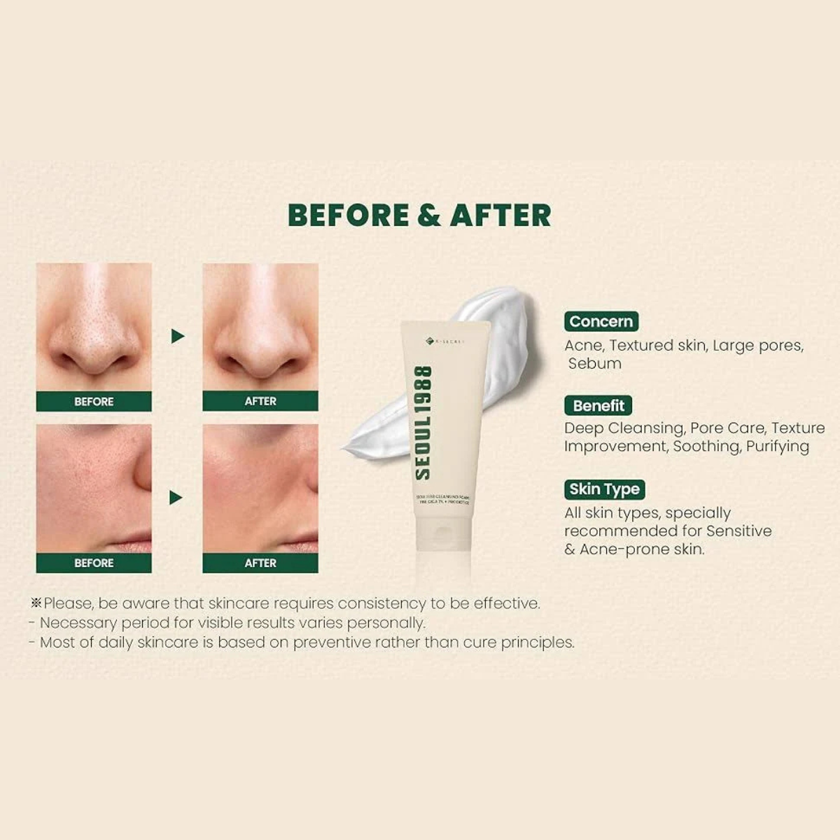 KSECRET - SEOUL 1988 Cleansing Foam: Pine Cica 1% + Probiotics - Detergente viso purificante con centella e probiotici