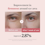 PDRN Pink Peptide Eye Cream – Crema contorno occhi anti-age e illuminante
