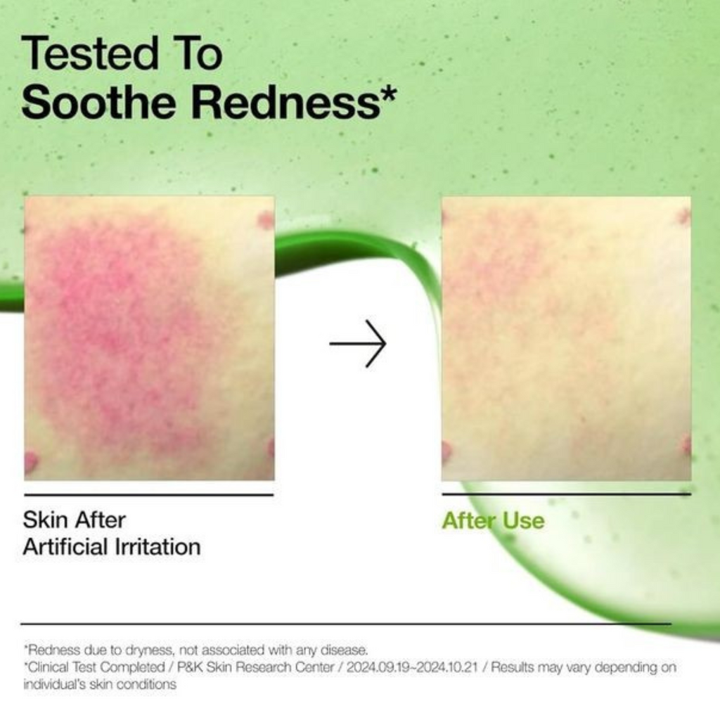 Anua – Azelaic Acid 10 Hyaluron Redness Soothing Serum – Siero viso lenitivo anti-rossori