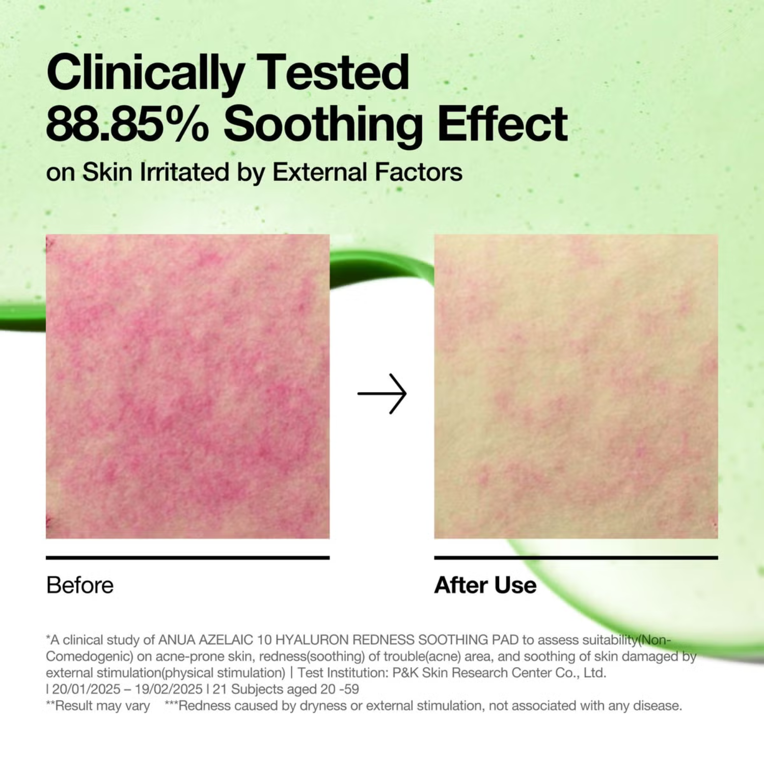 Anua – Azelaic Acid 10 Hyaluron Redness Soothing Pad – Dischetti viso lenitivi anti-rossori