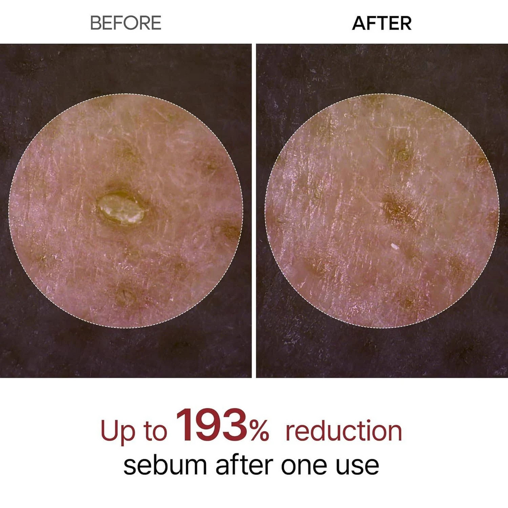 Dr.Melaxin – Peel Shot Exfoliant White Rice Ampoule – Ampoule viso esfoliante e illuminante al riso