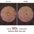 Dr.Melaxin – Peel Shot Exfoliant White Rice Ampoule – Ampoule viso esfoliante e illuminante al riso