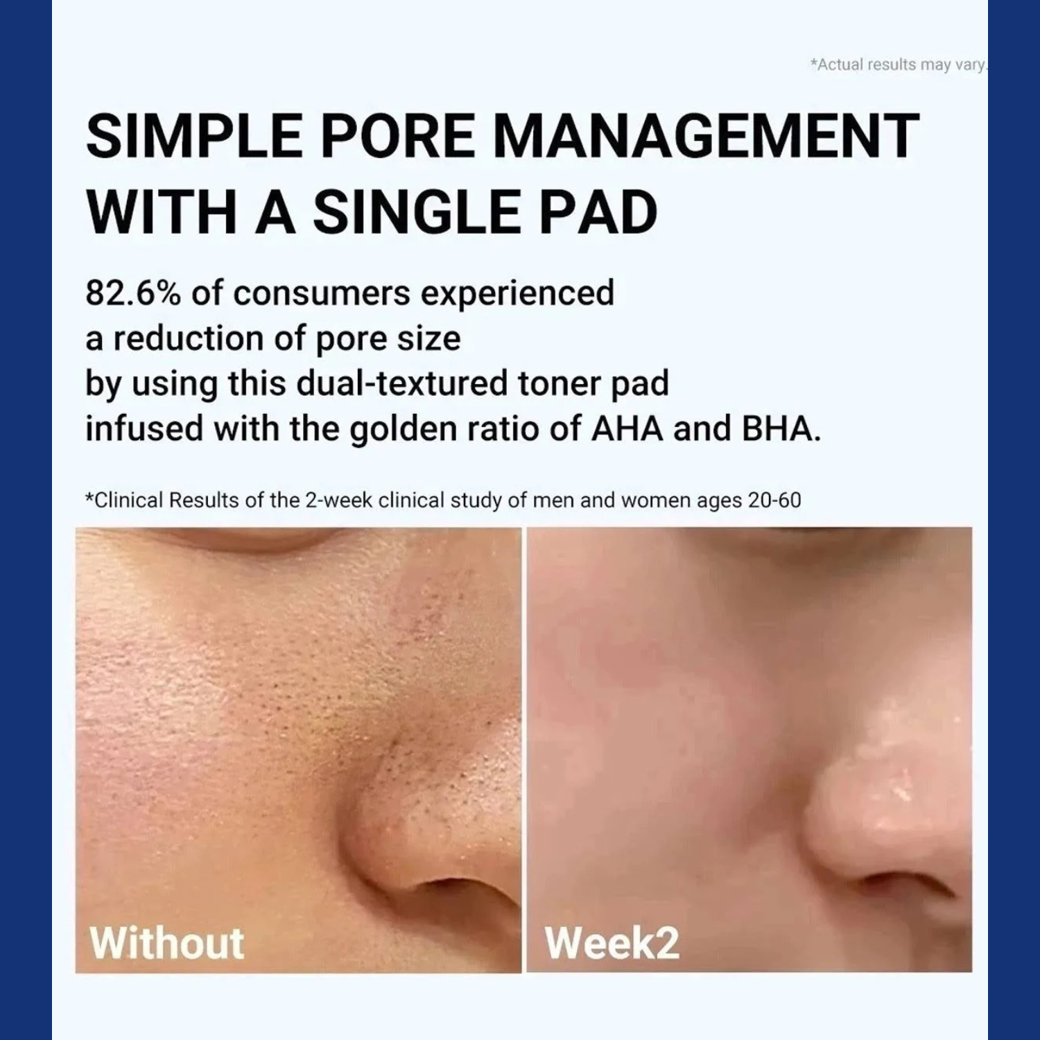 Medicube – Zero Pore Pad 2.0 – Dischetti viso esfolianti anti-pori e sebo