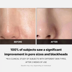 Medicube – Zero Pore Pad 2.0 – Dischetti viso esfolianti anti-pori e sebo