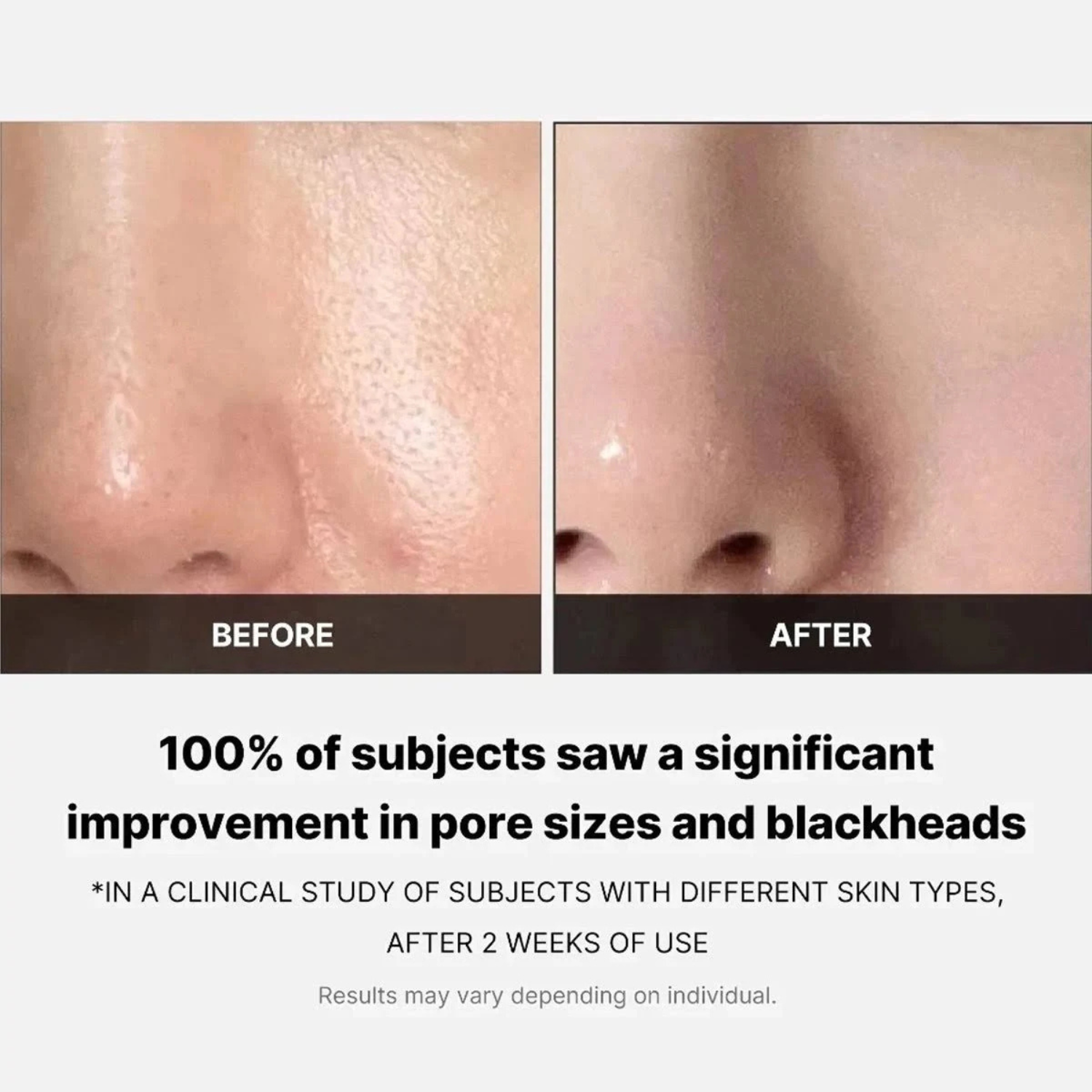 Medicube – Zero Pore Pad 2.0 – Dischetti viso esfolianti anti-pori e sebo