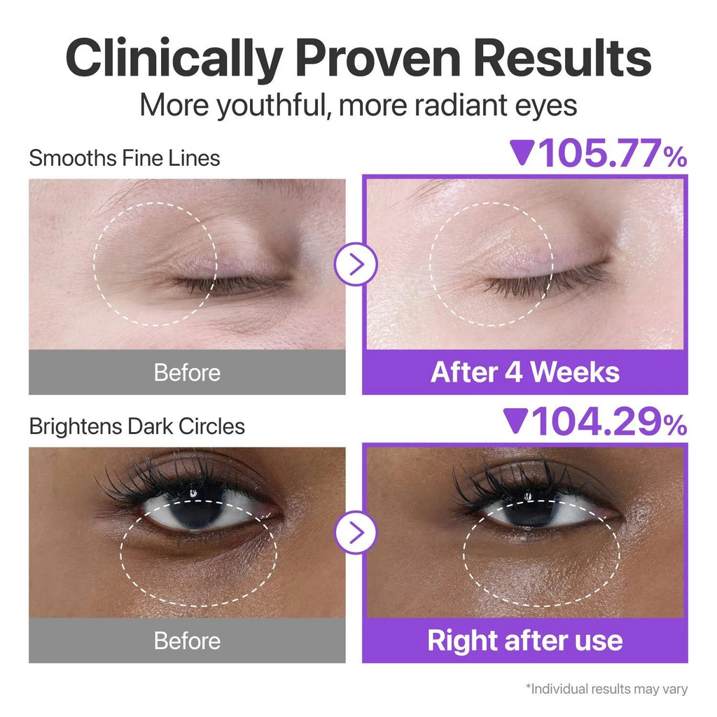 Numbuzin – No.9 NAD+ Retinol Volumetox Eye Cream – Crema contorno occhi anti-age al retinolo