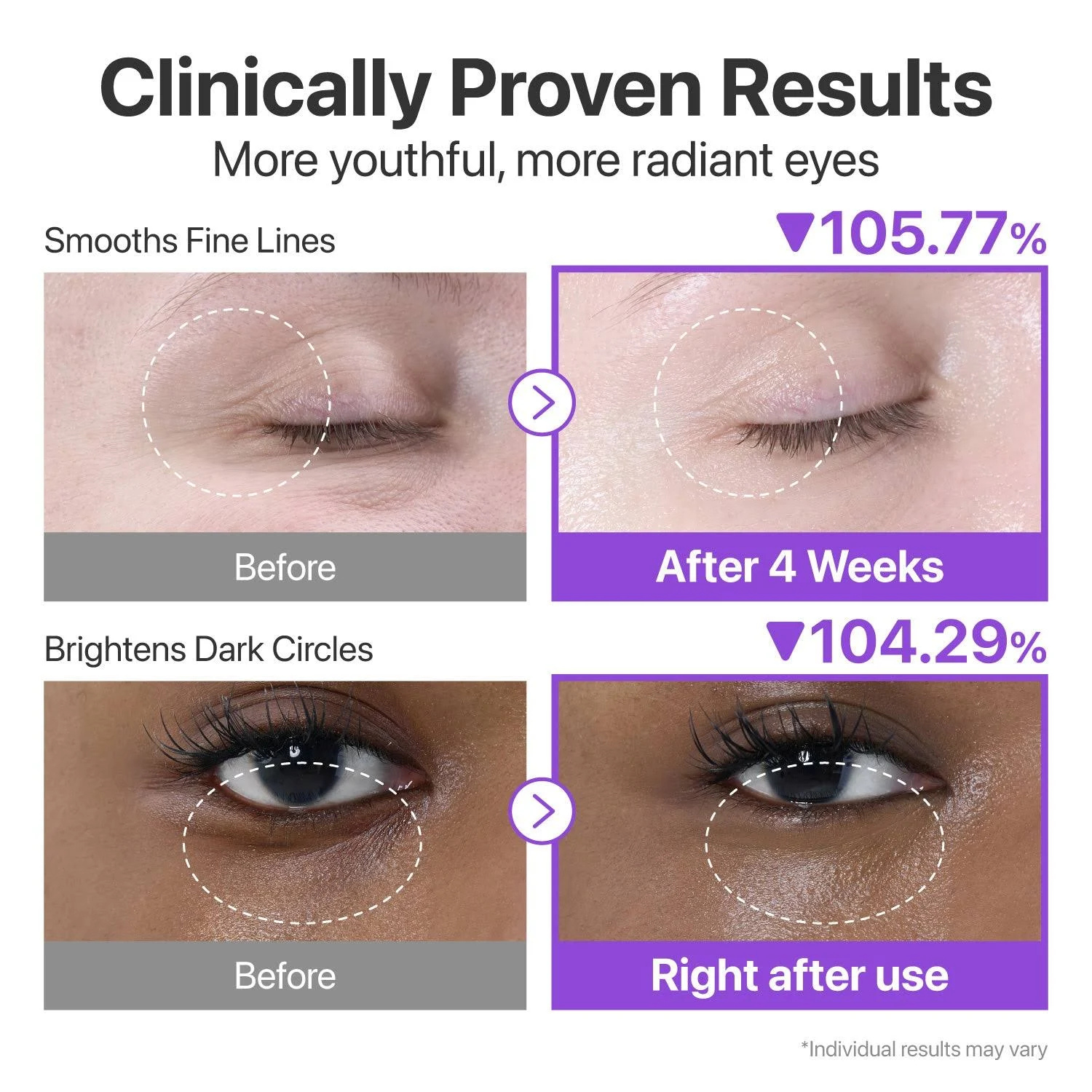 Numbuzin – No.9 NAD+ Retinol Volumetox Eye Cream – Crema contorno occhi anti-age al retinolo