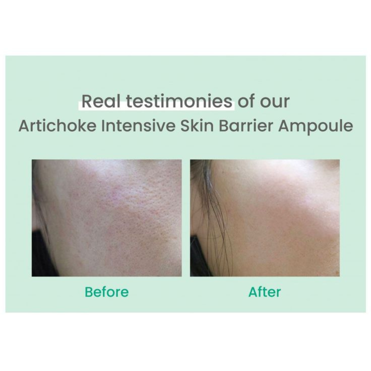 AXIS-Y - Artichoke Intensive Skin Barrier Ampoule - Siero viso idratante e rinforzante al carciofo