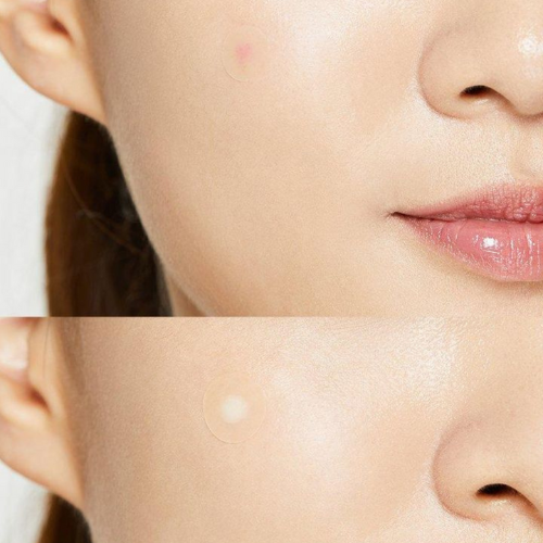 COSRX - Acne Pimple Master Patch - Cerotti anti-bruffoli per acne