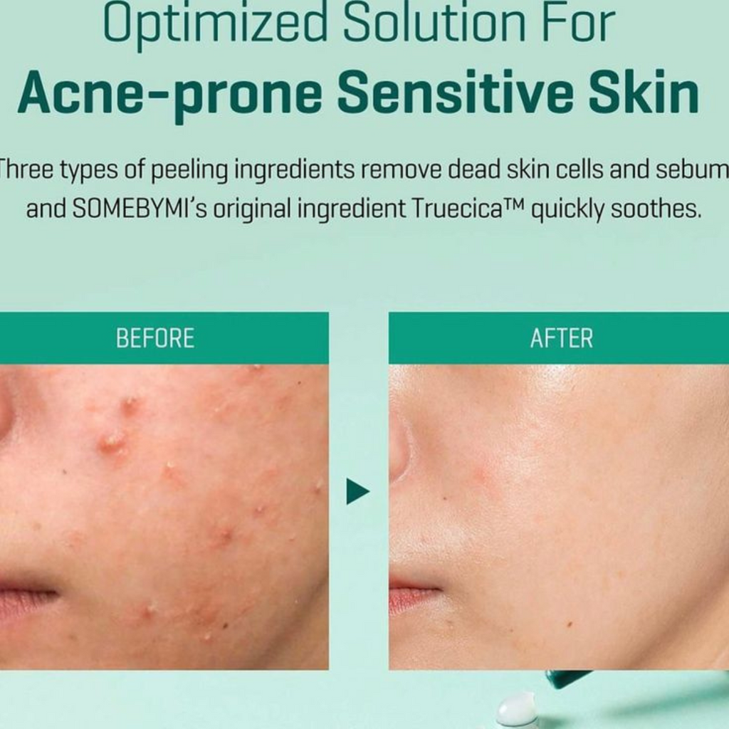 Some By Mi - AHA, BHA, PHA 14 Days Super Miracle Spot All Kill Cream - Crema anti-acne