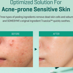 Some By Mi – AHA, BHA, PHA 14 Days Super Miracle Spot All Kill Cream - Crema anti-acne