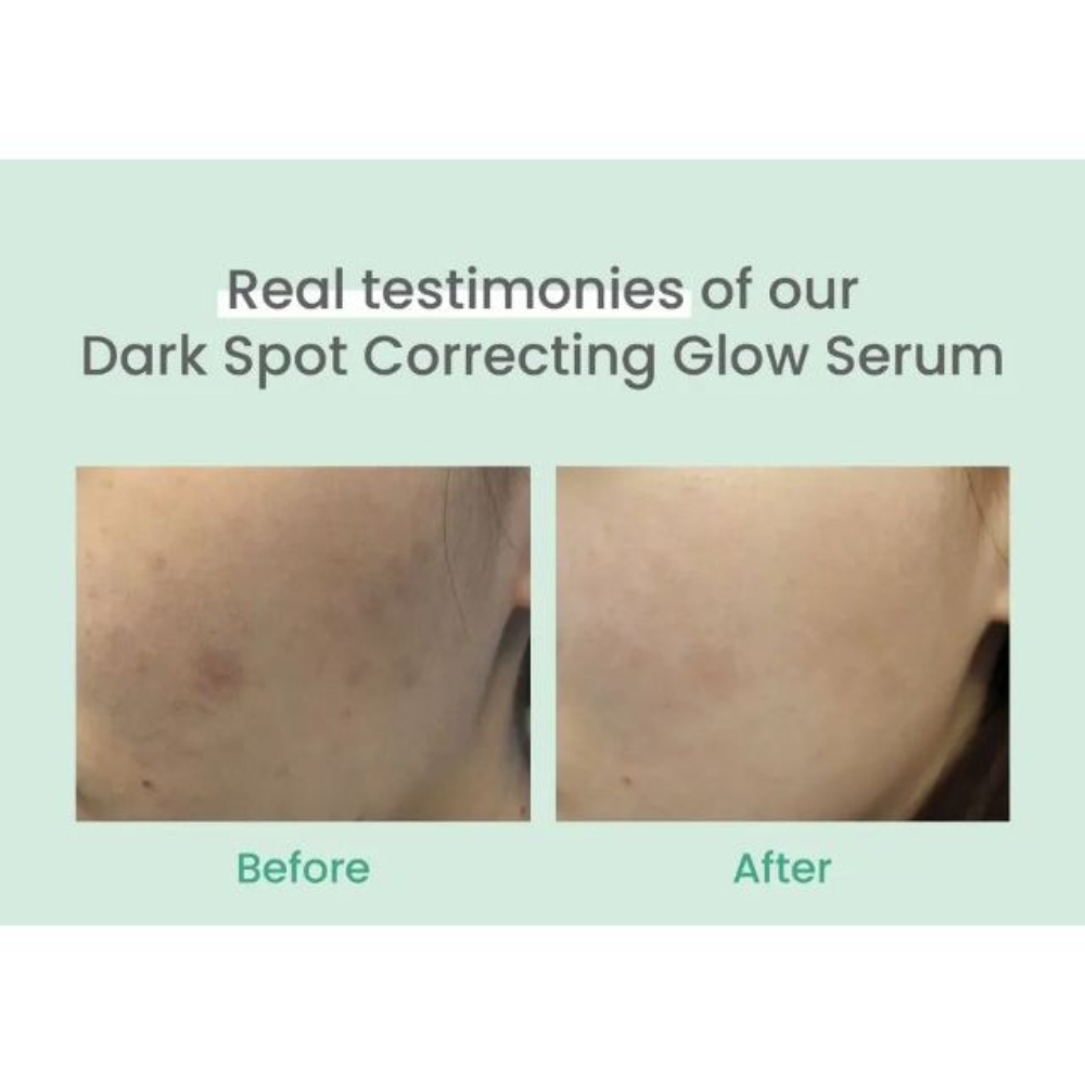 AXIS-Y - Dark Spot Correcting Glow Serum - Siero viso illuminante antimacchie alla niacinamide