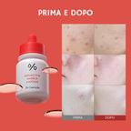 Azelaic 10 & Madeca Ampoule - Siero acido azelaico 10%